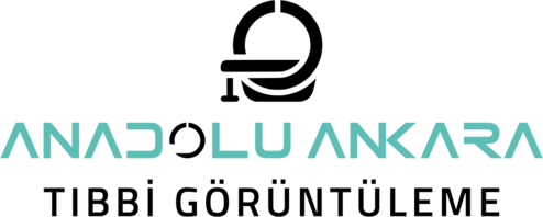 ANADOLU ANKARA